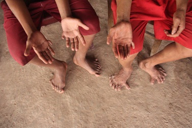 Kỳ lạ gia đình có 14 ngón chân, 12 ngón tay