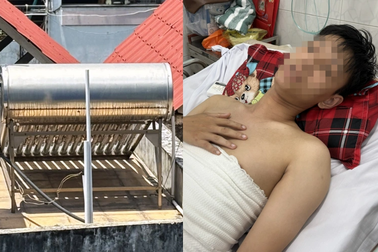 Ngã vào máy nước nóng năng lượng mặt trời, chàng trai bỏng nặng nửa người
