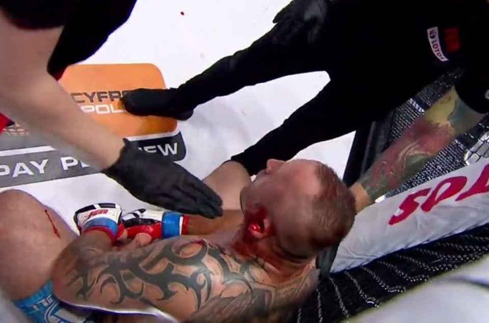 Võ sĩ MMA bị rách tai kinh hoàng - 1 Võ sĩ MMA bị rách tai kinh hoàng - 1