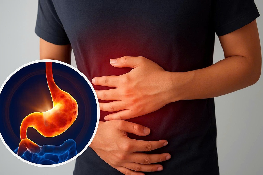 Captogastril - Giải pháp mới hỗ trợ đẩy lùi rối loạn tiêu hóa do dư axit dạ dày - 2 Captogastril - Giải pháp mới hỗ trợ đẩy lùi rối loạn tiêu hóa do dư axit dạ dày - 2