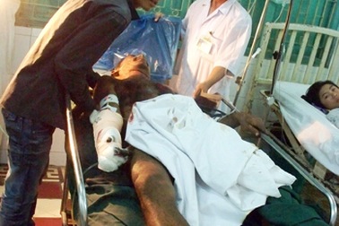 Hai người thương vong do mìn phát nổ khi đốt rẫy 