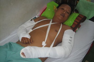 Bảo vệ công trình liên tục bị trộm tấn công