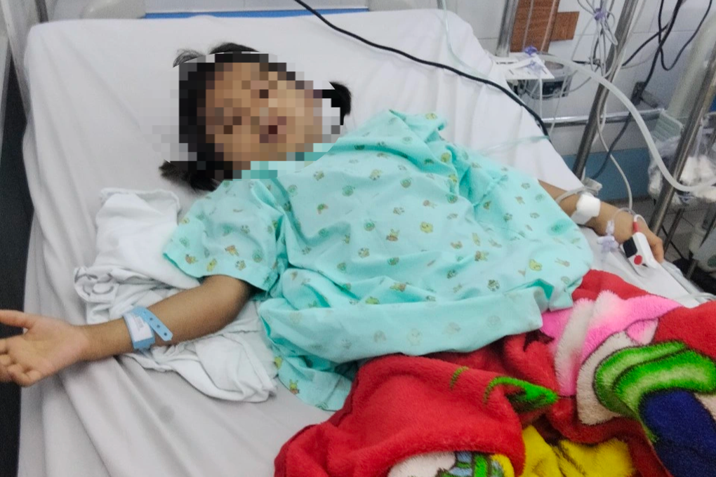 Bị ong vò vẽ tấn công, bé gái 7 tuổi nguy kịch - 1 Bị ong vò vẽ tấn công, bé gái 7 tuổi nguy kịch - 1