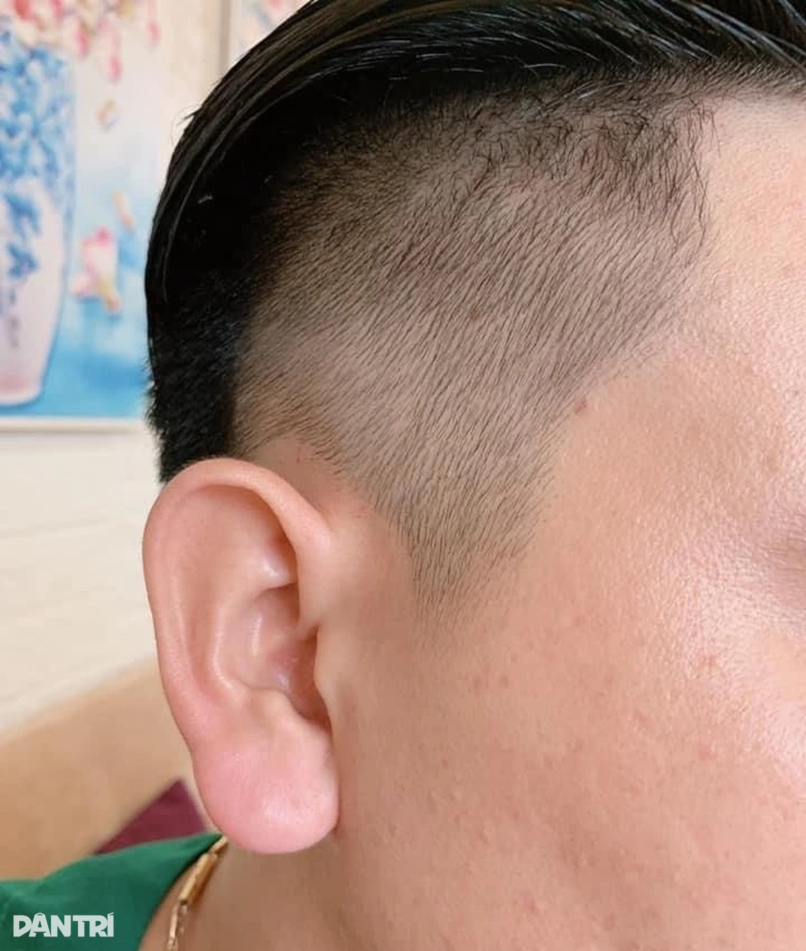Lạ lùng trào lưu đàn ông đua nhau đi tiêm tai Phật Di Lặc - 1 Lạ lùng trào lưu đàn ông đua nhau đi tiêm tai Phật Di Lặc - 1