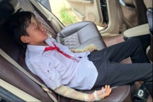 Vụ nổ bóng bay trong lễ khai giảng: Bóng bơm khí dễ phát nổ, gây bỏng rộng