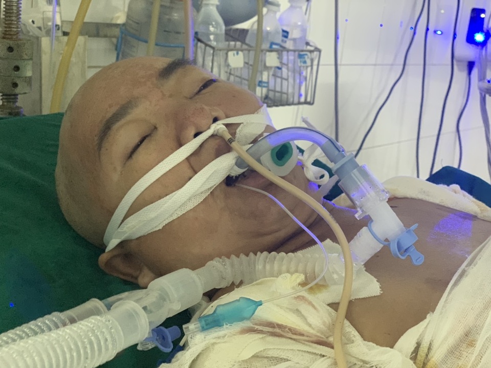 Đau nhói lòng cảnh người mẹ đi kiếm cái ăn nuôi 3 con bị ngã vào bếp hấp cá - 3 Đau nhói lòng cảnh người mẹ đi kiếm cái ăn nuôi 3 con bị ngã vào bếp hấp cá - 3