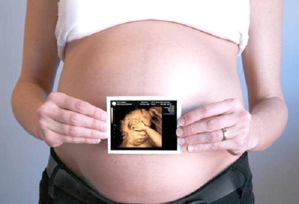Khoảnh khắc đầu tiên mẹ nhìn rõ mặt con khi siêu âm 4D - 3 Khoảnh khắc đầu tiên mẹ nhìn rõ mặt con khi siêu âm 4D - 3
