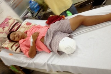 Vụ bệnh nhân bị cưa chân: Đúng quy trình nhưng đánh giá... chưa đầy đủ