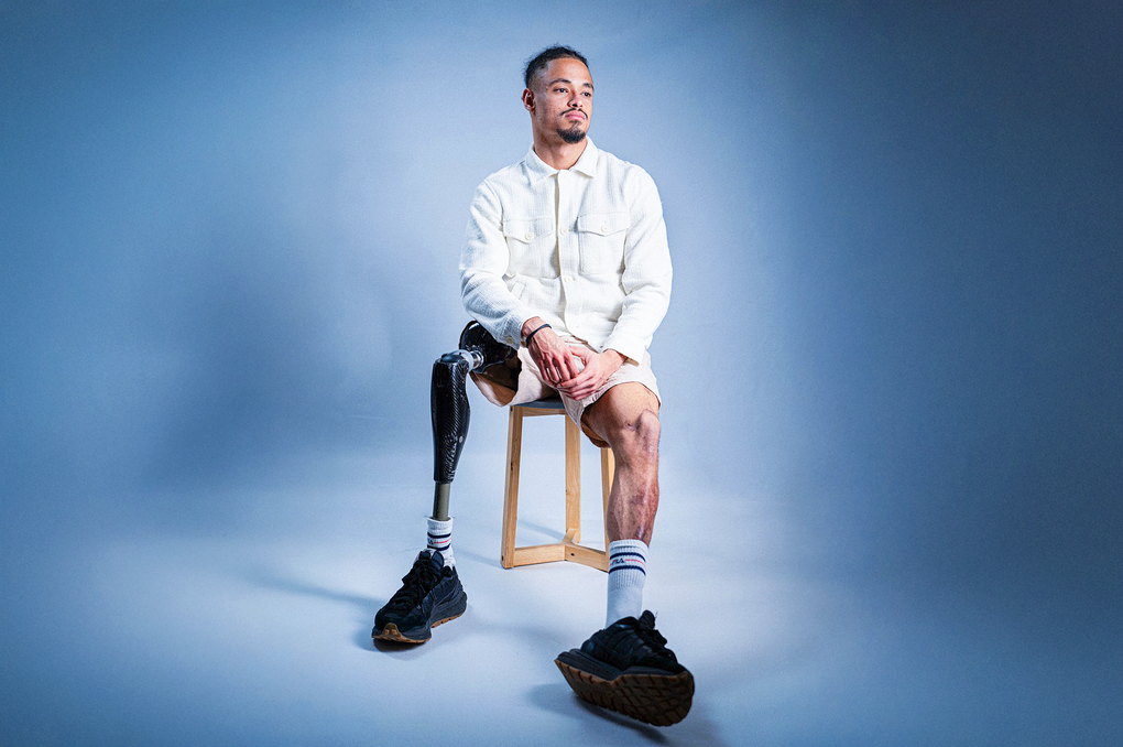 Câu chuyện của cầu thủ bóng đá Pháp phải cắt chân do mắc “bệnh tử 24 giờ” - 3