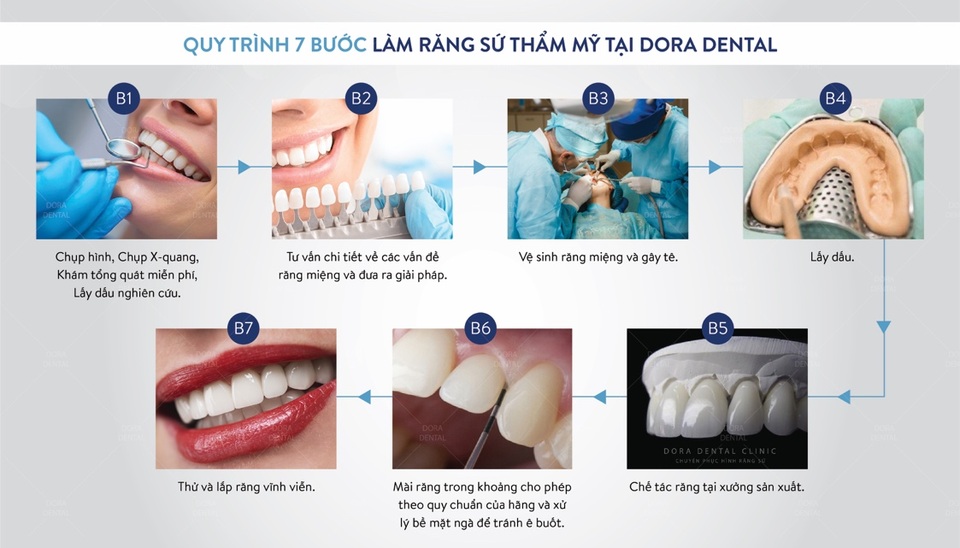 Phục hình răng sứ thẩm mỹ tại Dora có đáng lo ngại? - 3 Phục hình răng sứ thẩm mỹ tại Dora có đáng lo ngại? - 3