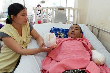 Báo động hàng loạt phế nhân do tai nạn bỏng điện