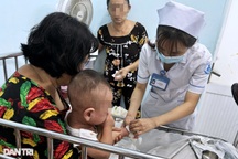 TPHCM tăng ca mắc sởi ngoại trú, đã có 3 trường hợp tử vong từ đầu năm