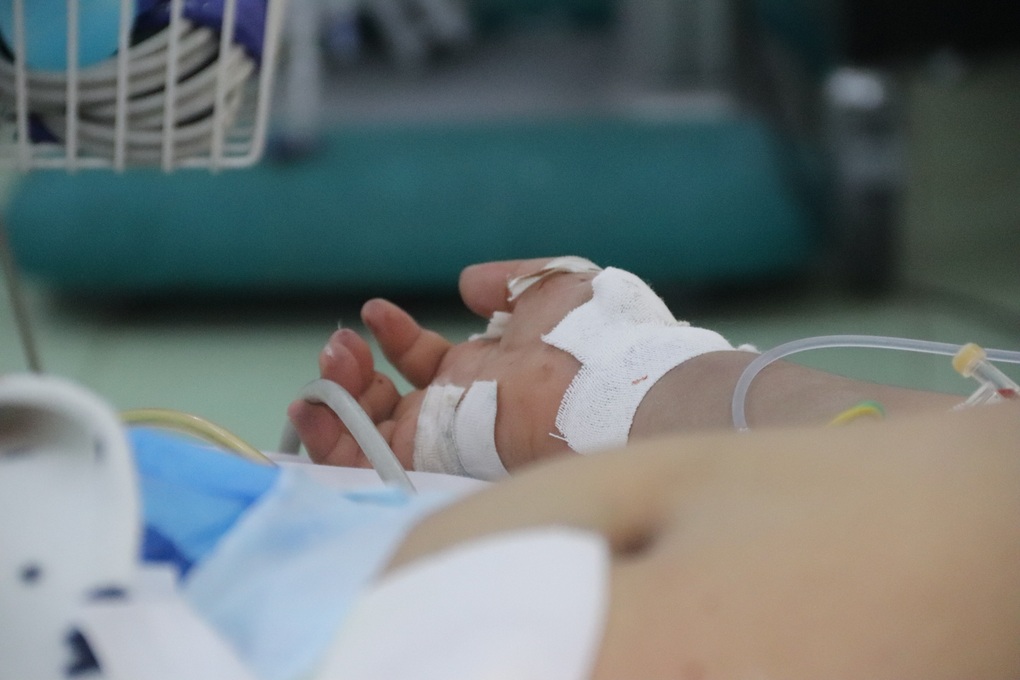 Nếu không có vaccine, chúng ta chỉ đi theo đuôi sốt xuất huyết - 1 Nếu không có vaccine, chúng ta chỉ đi theo đuôi sốt xuất huyết - 1