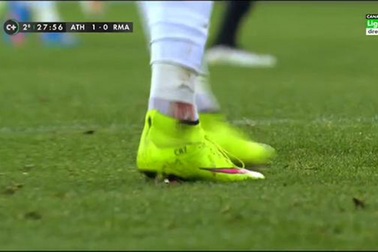 Cố kiếm phạt đền, C.Ronaldo suýt vỡ mắt cá chân