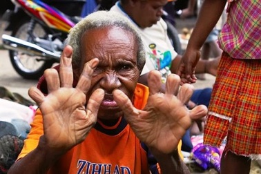 Cắt cụt ngón tay để thể hiện lòng xót thương với người chết