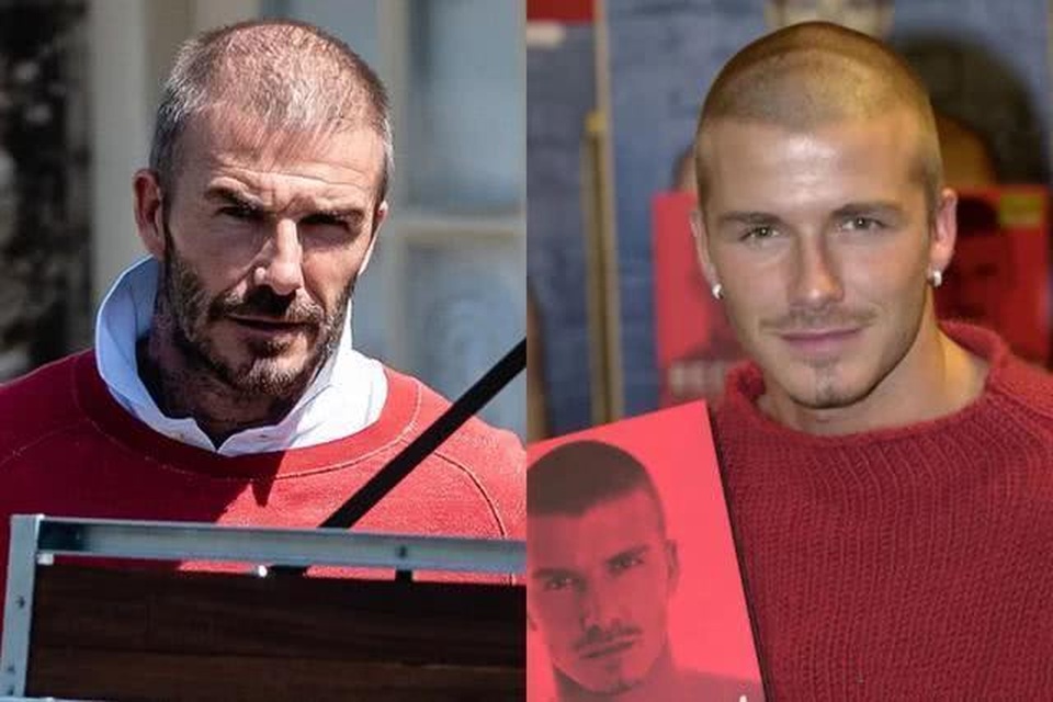 David Beckham đối mặt với chứng rụng tóc và tuổi tác - 5 David Beckham đối mặt với chứng rụng tóc và tuổi tác - 5