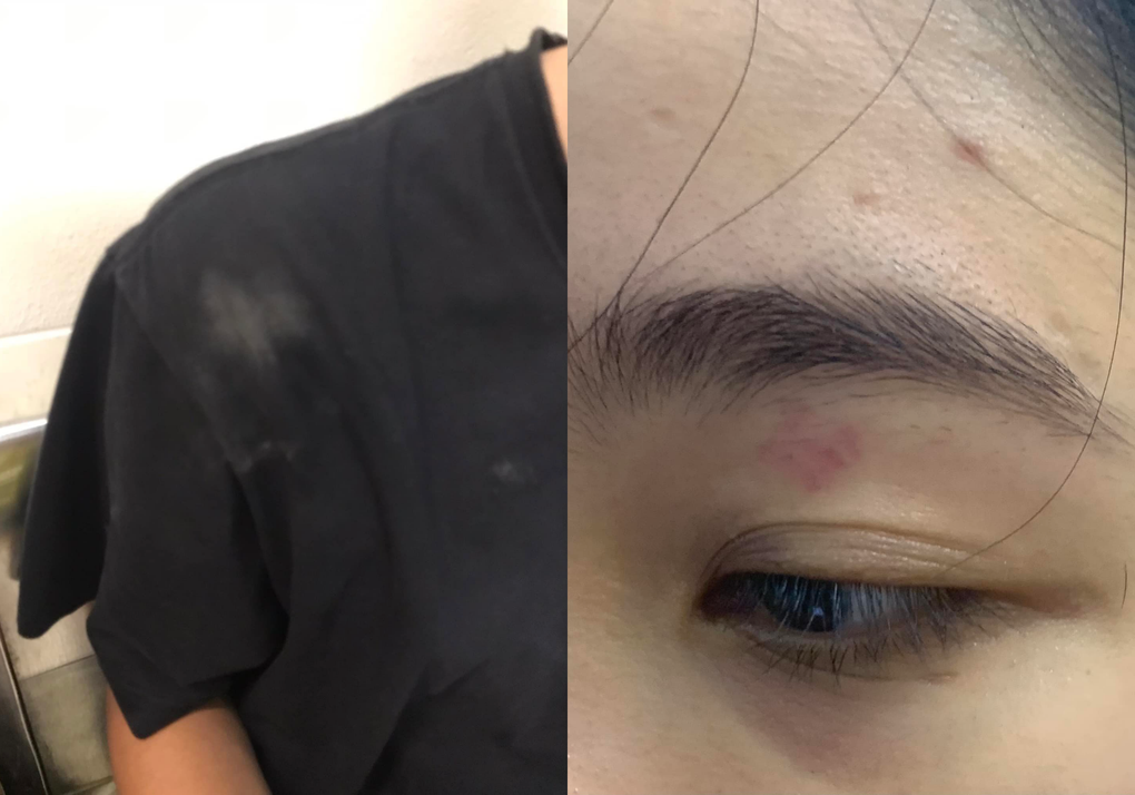Cô gái bị đánh, chửi ngu dốt ở quán bánh mì: Do mang nước từ bên ngoài vào? - 1 Cô gái bị đánh, chửi ngu dốt ở quán bánh mì: Do mang nước từ bên ngoài vào? - 1