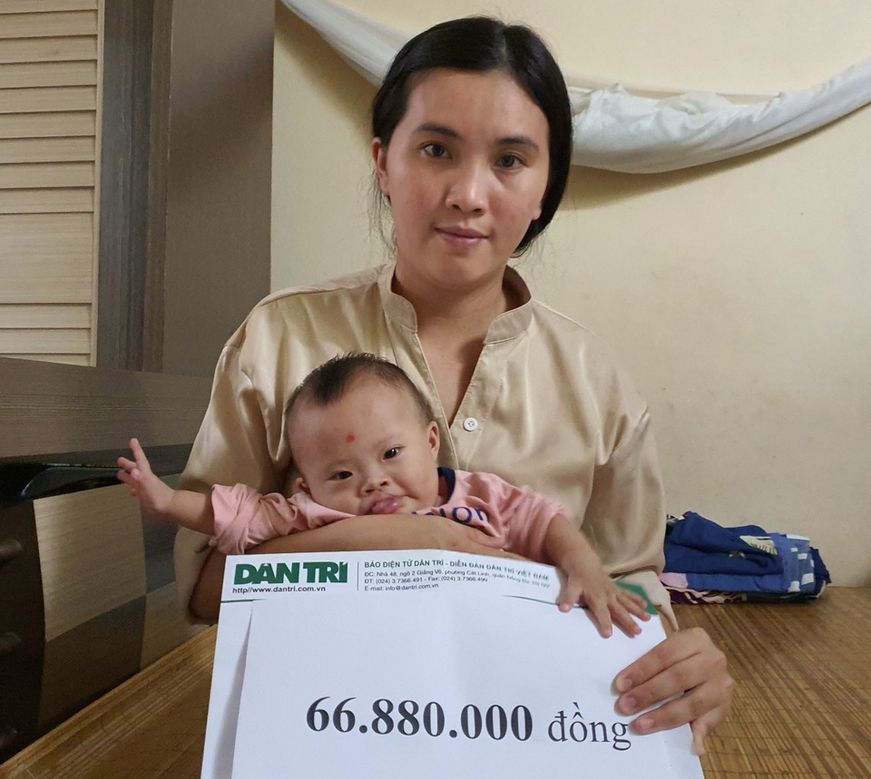 Bạn đọc Dân trí tiếp tục giúp đỡ bé gái mắc đa dị tật hơn 66 triệu đồng - 1 Bạn đọc Dân trí tiếp tục giúp đỡ bé gái mắc đa dị tật hơn 66 triệu đồng - 1
