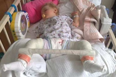 Cô bé luôn bị trật khớp khi vận động