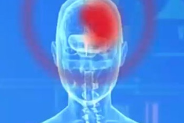 Chuyên gia nói về chứng đau nửa đầu khi giao mùa