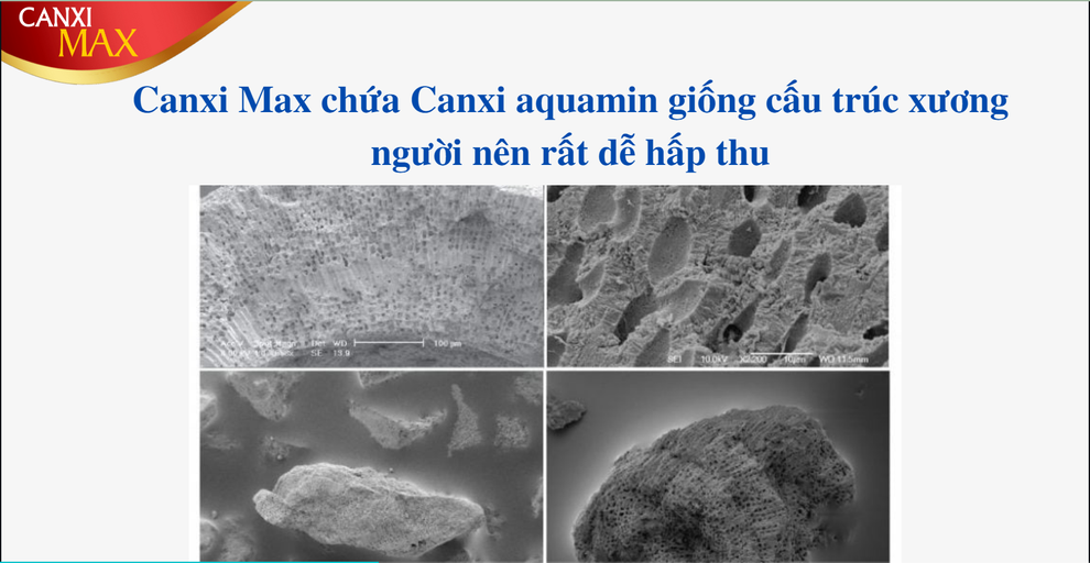 Canxi Max - lời giải cho mẹ đang đau đầu khi chọn canxi cho con - 4 Canxi Max - lời giải cho mẹ đang đau đầu khi chọn canxi cho con - 4