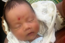 Phát hiện trẻ sơ sinh nằm khóc một mình trên đê biển lúc rạng sáng