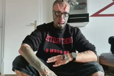 Chi 6000 bảng Anh chỉnh sửa cơ thể theo cách "không giống ai"