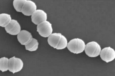 Nhật Bản: Số ca bệnh nhiễm trùng có tỷ lệ tử vong tới 30% tăng mạnh