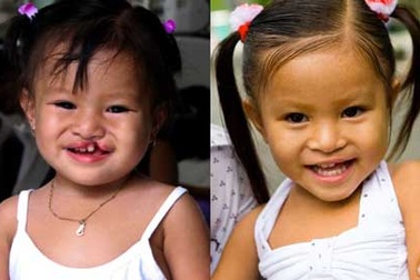 Tạo nụ cười ấm áp cho trẻ thơ