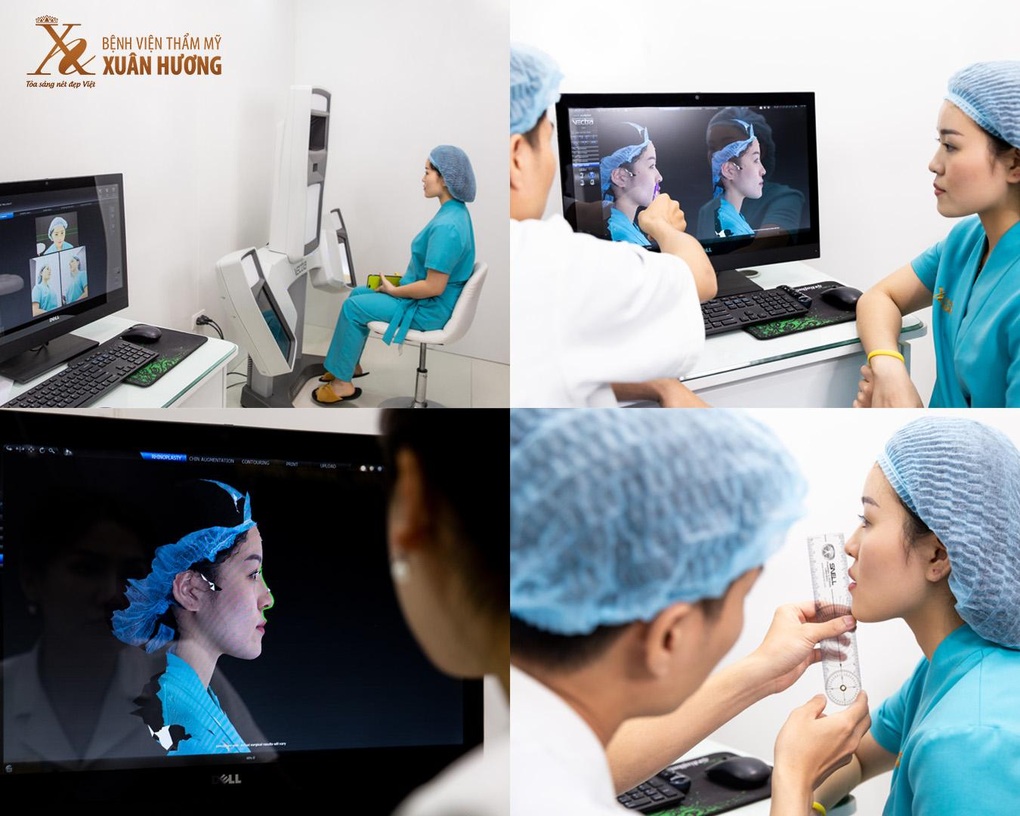 Làm đẹp đón Tết, bệnh viện thẩm mỹ Xuân Hương trợ giá đến 80% - 3 Làm đẹp đón Tết, bệnh viện thẩm mỹ Xuân Hương trợ giá đến 80% - 3