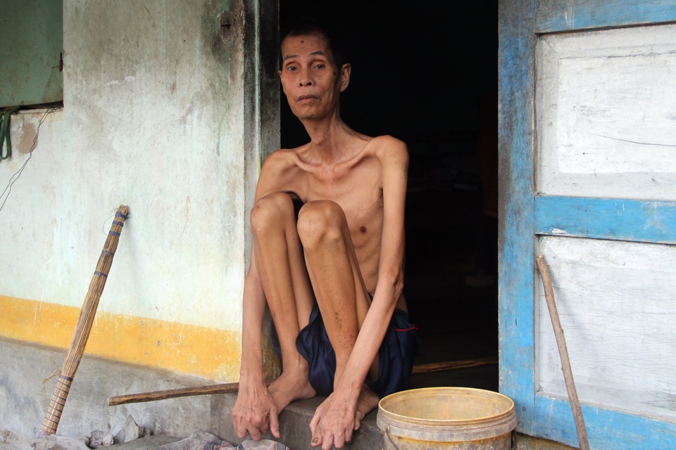 Thương người đàn ông gầy nhất vùng trong ngôi nhà 4 mảnh đời nghèo bền vững - 2 Thương người đàn ông gầy nhất vùng trong ngôi nhà 4 mảnh đời nghèo bền vững - 2
