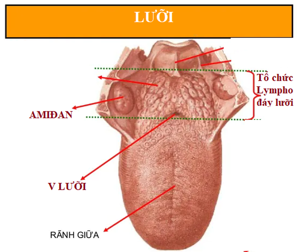 Khối, nốt đỏ sau lưỡi và đáy lưỡi - u hay ung thư? - 1 Khối, nốt đỏ sau lưỡi và đáy lưỡi - u hay ung thư? - 1