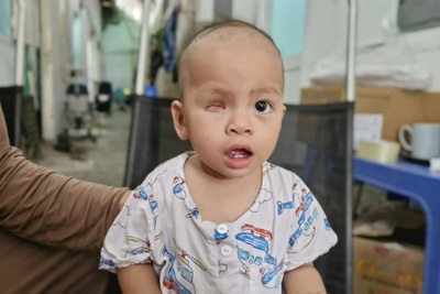 Mẹ nghèo cầu xin cứu con mắt còn lại của bé trai 2 tuổi