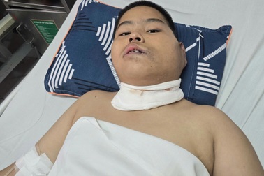 Mắc bệnh hiểm, cậu bé 15 tuổi phải ngủ ngồi suốt 10 năm