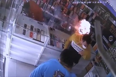 Hú vía khoảnh khắc smartphone phát nổ khiến lửa trùm lên đầu trong tích tắc