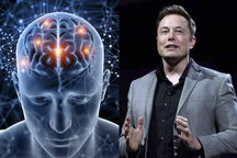 Chip não của Elon Musk gặp sự cố sau 3 tháng cấy vào bệnh nhân