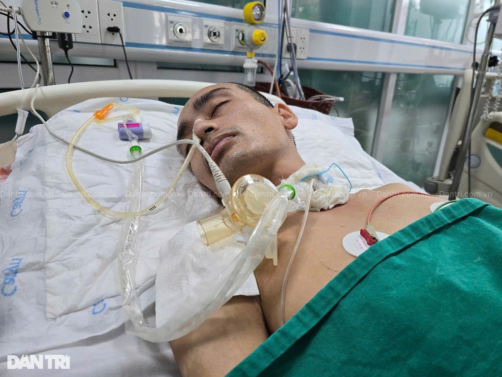 Chồng bị rắn hổ mang chúa cắn nguy kịch, vợ nghèo ôm con thơ cầu cứu - 3 Chồng bị rắn hổ mang chúa cắn nguy kịch, vợ nghèo ôm con thơ cầu cứu - 3