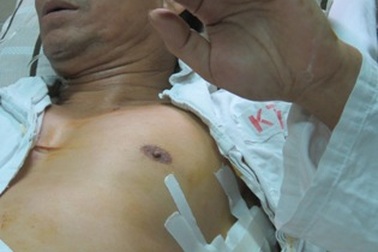 Giám đốc công ty vận tải bị chém trọng thương ngay tại cửa nhà