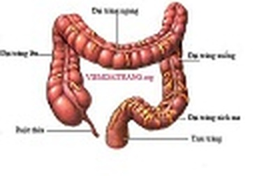 Bệnh viêm đại tràng mạn tính