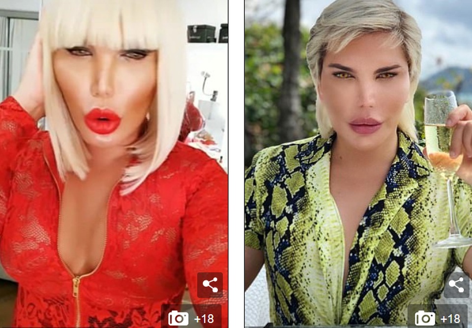 Sao nghiện dao kéo Rodrigo Alves xuất hiện sau tuyên bố chuyển giới - 7 Sao nghiện dao kéo Rodrigo Alves xuất hiện sau tuyên bố chuyển giới - 7