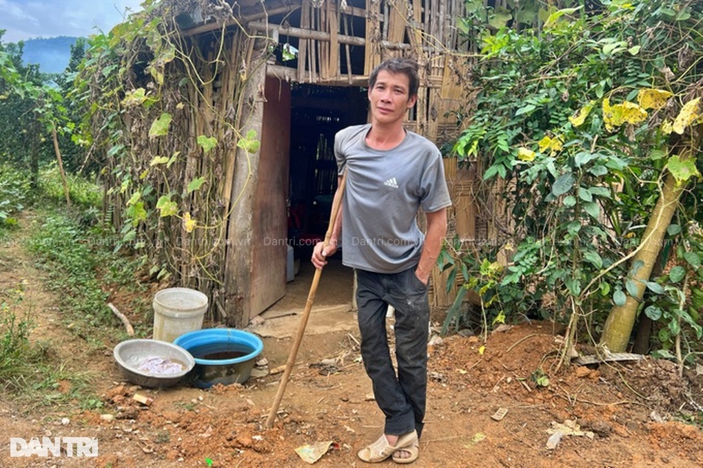 Người đàn ông khuyết tật sống mòn ở túp lều tạm 14 năm ước không ốm đau - 2 Người đàn ông khuyết tật sống mòn ở túp lều tạm 14 năm ước không ốm đau - 2