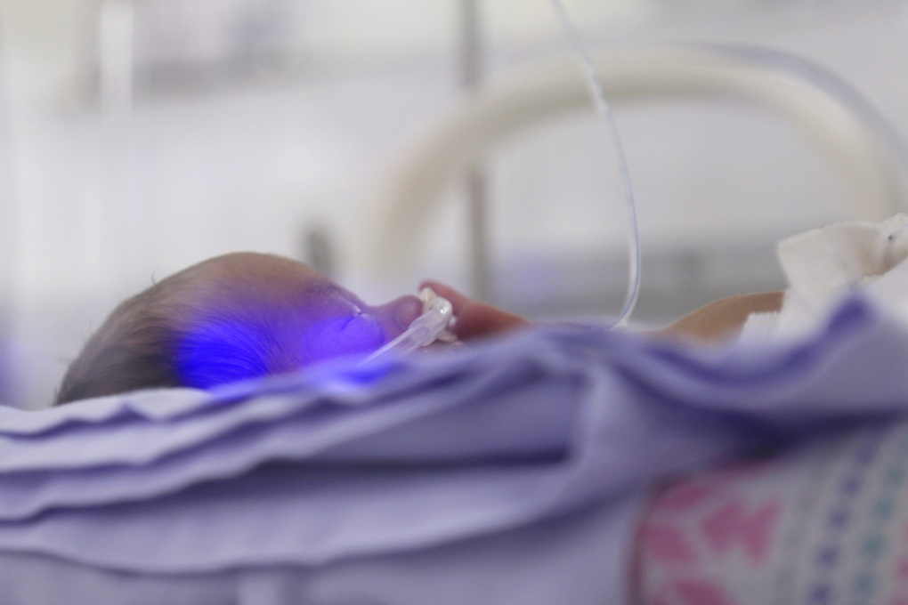 TPHCM: Người mẹ mất hơn 5 lít máu, suy tim, phù phổi và vỡ gan lúc sinh con - 3 TPHCM: Người mẹ mất hơn 5 lít máu, suy tim, phù phổi và vỡ gan lúc sinh con - 3