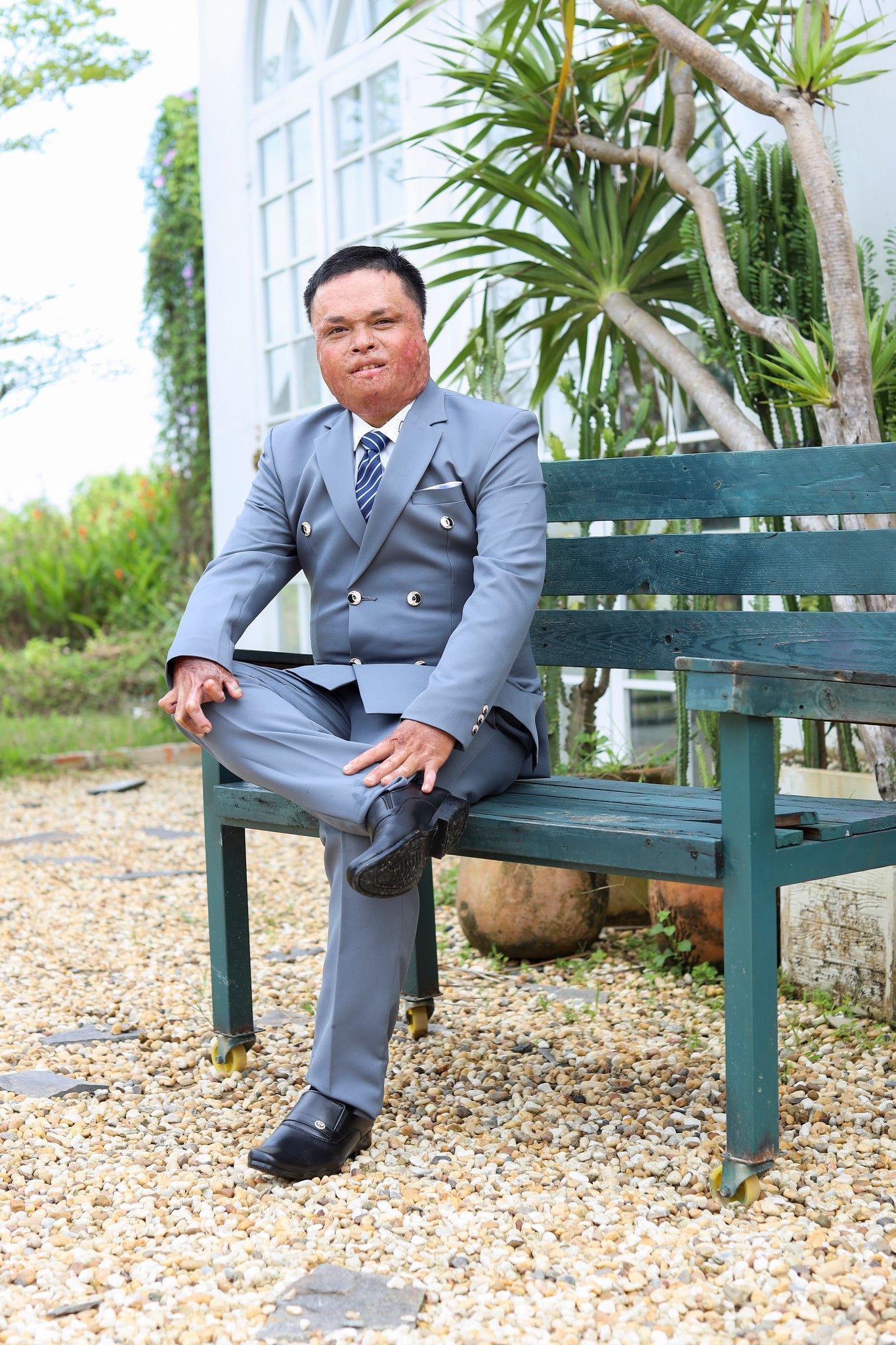 Tình yêu hồi sinh bà mẹ hai con từng bị chồng cũ thiêu sống - 6 Tình yêu hồi sinh bà mẹ hai con từng bị chồng cũ thiêu sống - 6