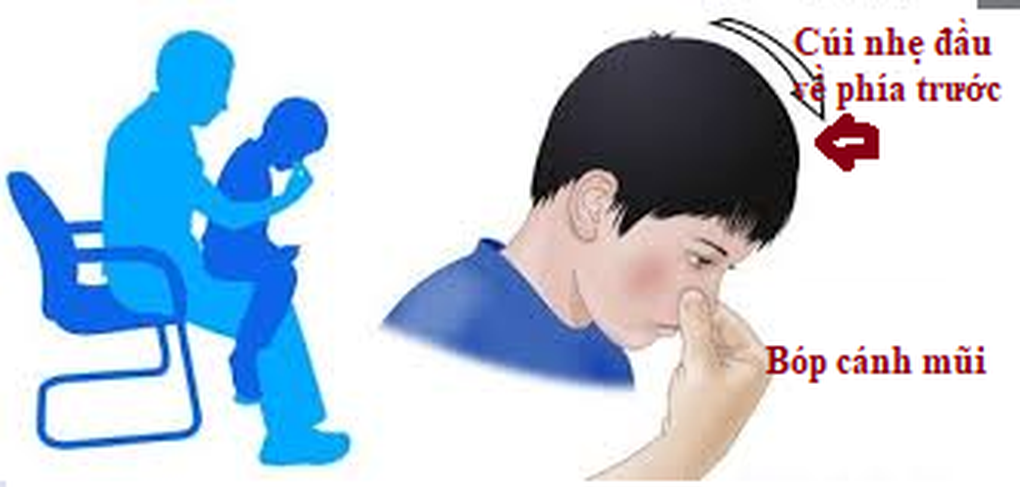 Trẻ hay chảy máu mũi vào mùa đông có nguy hiểm? - 1 Trẻ hay chảy máu mũi vào mùa đông có nguy hiểm? - 1