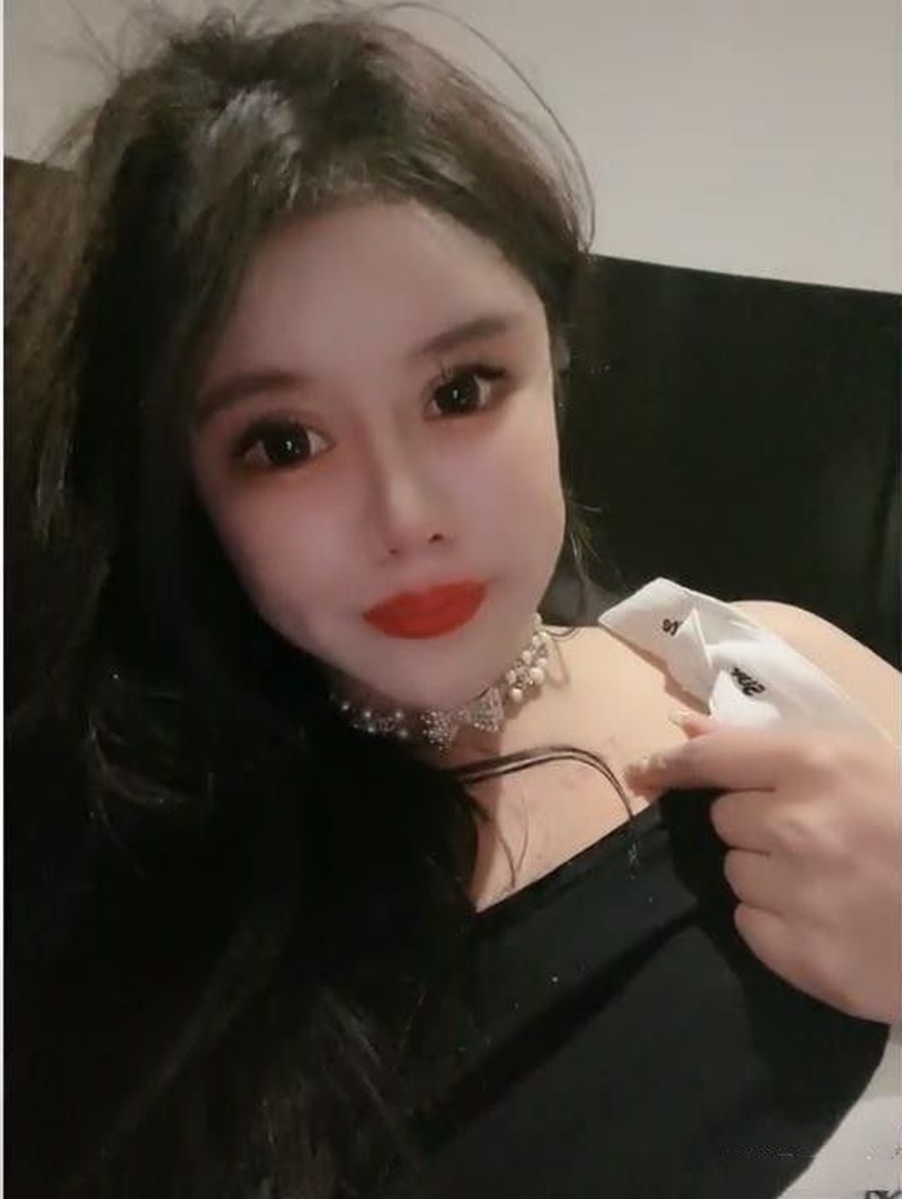 Gương mặt biến dạng của hotgirl nghiện dao kéo thẩm mỹ từ năm 13 tuổi - 2 Gương mặt biến dạng của hotgirl nghiện dao kéo thẩm mỹ từ năm 13 tuổi - 2