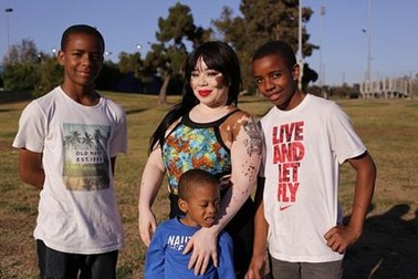 Bà mẹ mắc bệnh bạch biến trở thành ngôi sao mạng xã hội