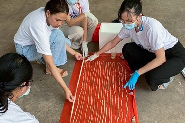 Thái Lan: Chữa cho người đau bụng dữ dội, bác sĩ sốc với thứ chui khỏi người bệnh nhân