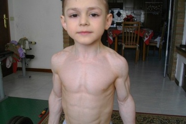 Những căn bệnh có một không hai trên thế giới