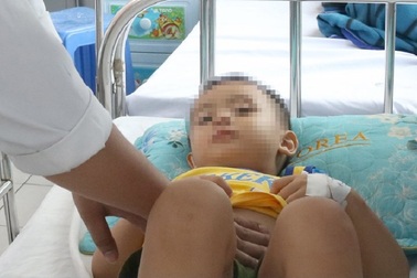 Bé trai 3 tuổi vỡ lách vì lỗi thường gặp của bố mẹ chở con bằng xe máy