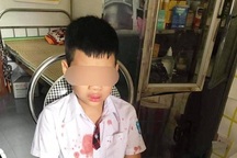 Phụ huynh vào trường đánh bé trai lớp 1 để... giải quyết mâu thuẫn cho con